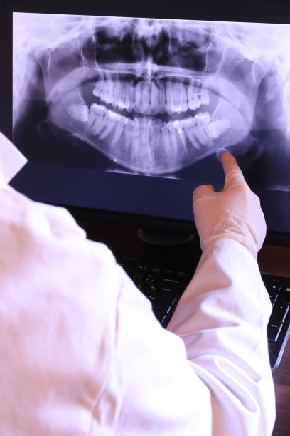 Best Emergency Dental Care for Broken or Chipped Teeth in Adelino, NM