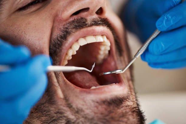Best Emergency Denture Repair in Adelino, NM
